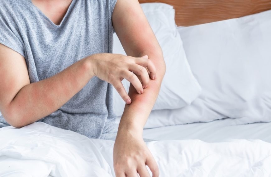 La lutte contre les acariens : comment garder sa maison allergène-free